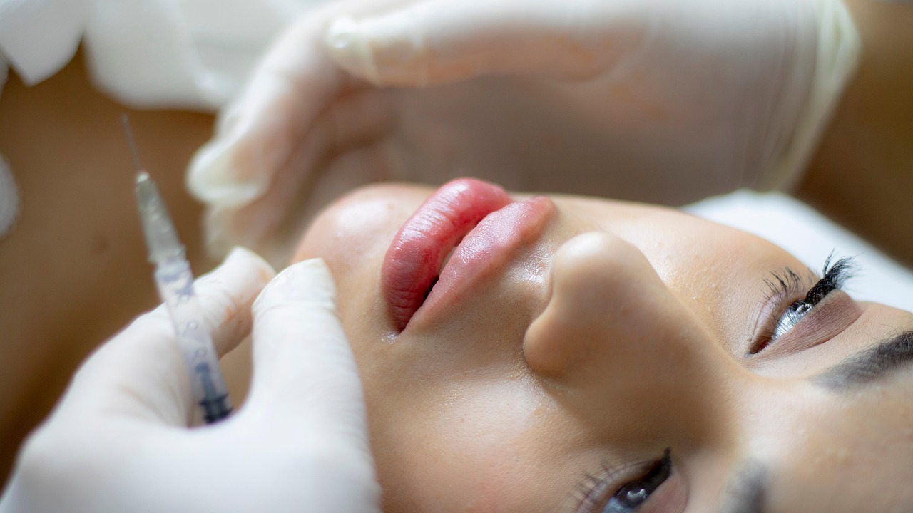 Dermal Filler in Sacramento 2026: How to Choose a Provider and Plan Natural Results