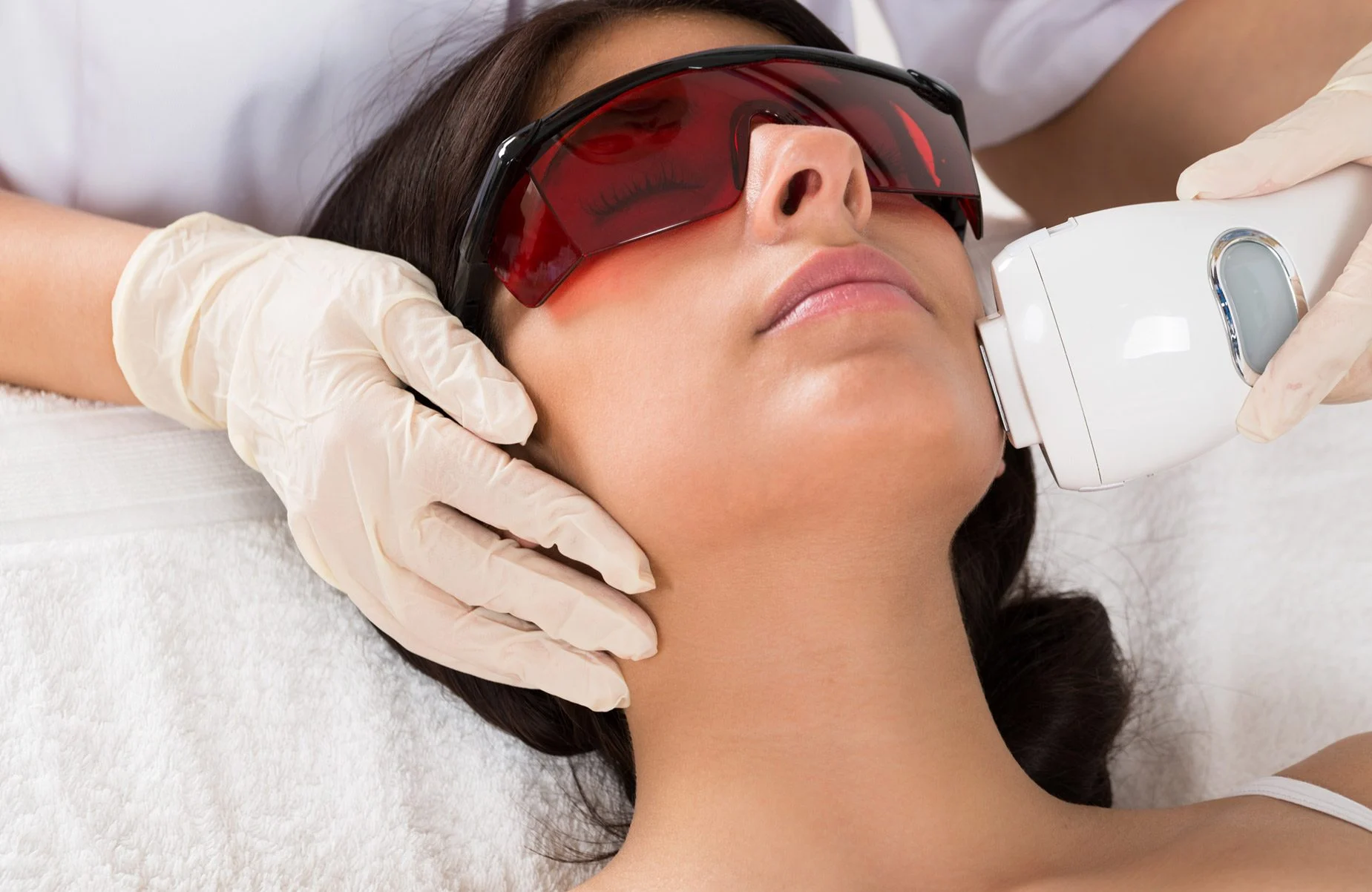 laser hair removal excelsior